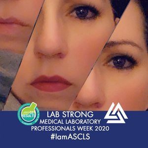 Meet your Posher, Joey